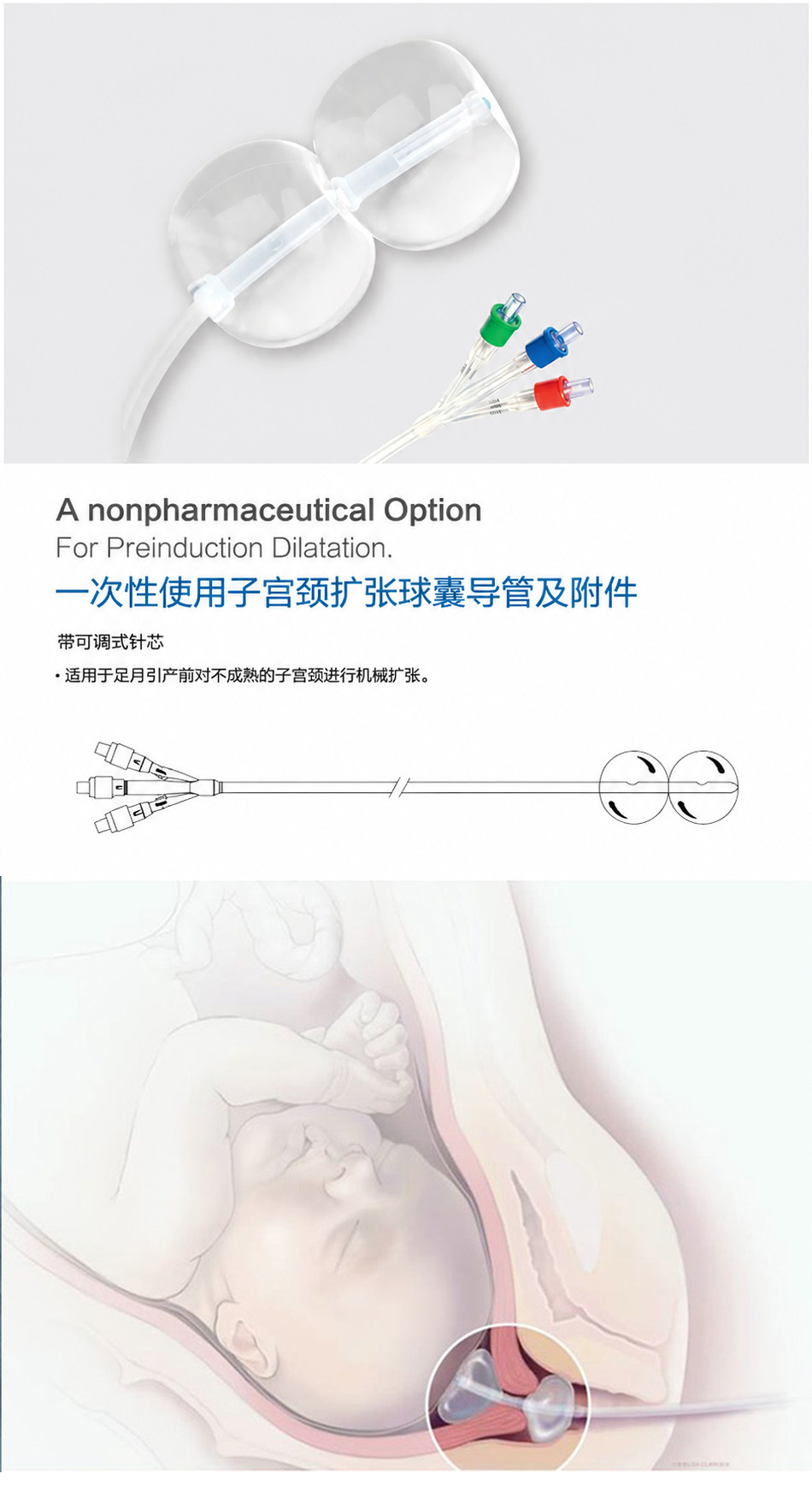 双球囊无菌子宫颈扩张球囊详情页